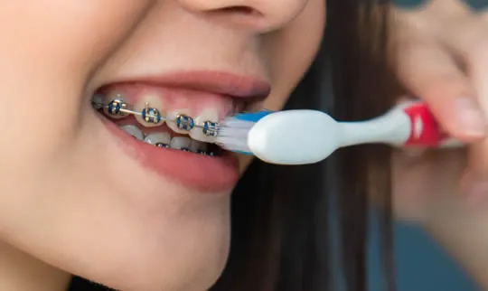 brushing metal dental braces